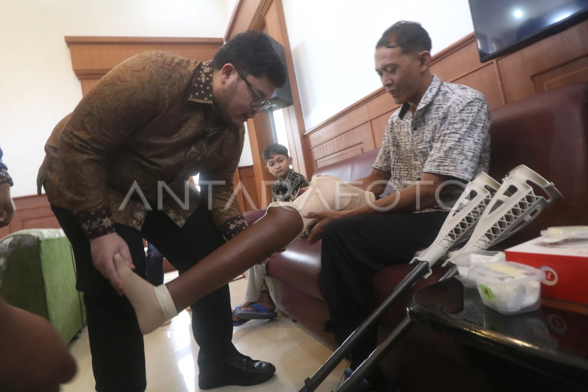 Penyerahan Bantuan Alat Bantu Penyandang Disabilitas Antara Foto