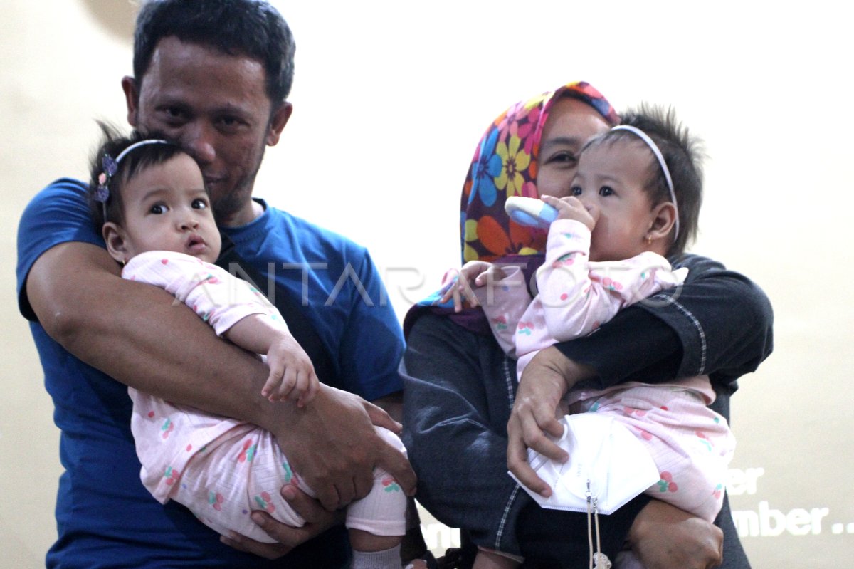 Pemulangan Bayi Kembar Siam Di Malang | ANTARA Foto