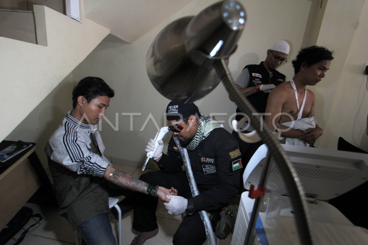 HAPUS TATO GRATIS ANTARA Foto
