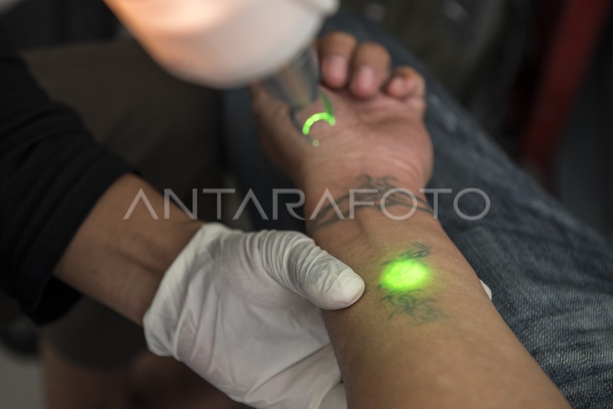 HAPUS TATO GRATIS ANTARA Foto