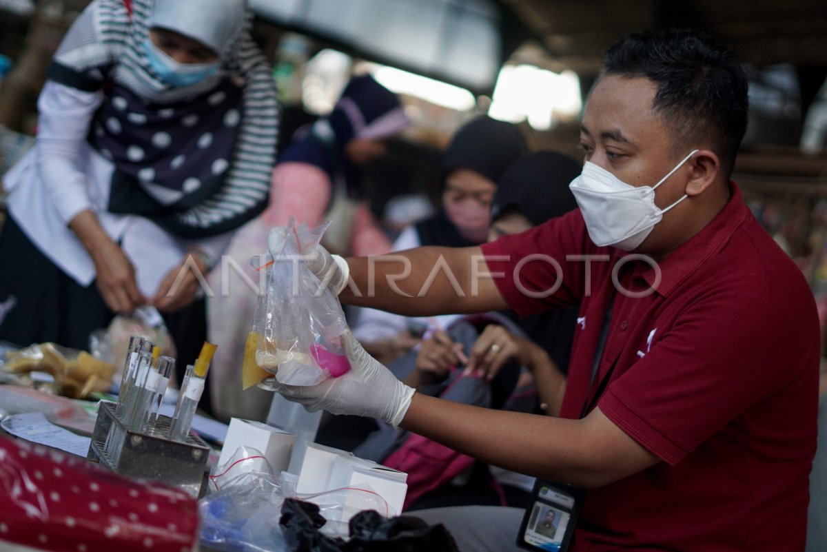 UJI LABORATORIUM SAMPEL MAKANAN DI PASAR | ANTARA Foto