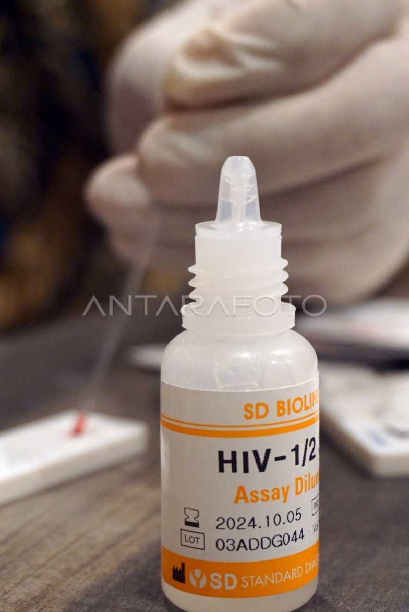 Tes HIV AIDS sukarela ungkap angka HIV AIDS di Papua Barat